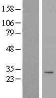 TIMMDC1 Human Over-expression Lysate