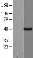 CYP39A1 Human Over-expression Lysate