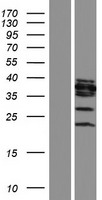 OGG1 Human Over-expression Lysate