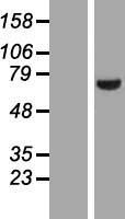 LIM kinase 2 (LIMK2) Human Over-expression Lysate