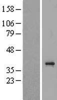 TAS2R3 Human Over-expression Lysate