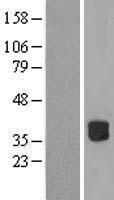 RWDD2B Human Over-expression Lysate