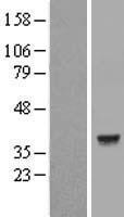 Lactate Dehydrogenase C (LDHC) Human Over-expression Lysate