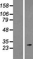 ROPN1 Human Over-expression Lysate