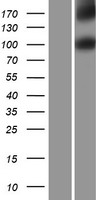 IL17RD Human Over-expression Lysate