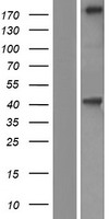 KIF21B Human Over-expression Lysate