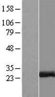 ZCCHC10 Human Over-expression Lysate