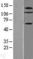 ZNF280D Human Over-expression Lysate
