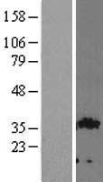 GIPC (GIPC2) Human Over-expression Lysate