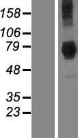Dymeclin (DYM) Human Over-expression Lysate