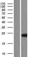 MED18 Human Over-expression Lysate