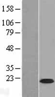 C9orf7 (CACFD1) Human Over-expression Lysate