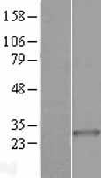 ARHGEF38 Human Over-expression Lysate