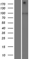 SIDT1 Human Over-expression Lysate