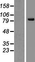 SNRK Human Over-expression Lysate