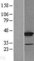 THUMPD1 Human Over-expression Lysate