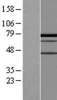 PALMD Human Over-expression Lysate