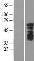 YTHDF1 Human Over-expression Lysate