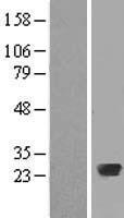 RAB20 Human Over-expression Lysate