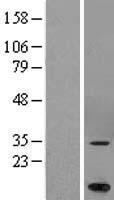 MARCHF5 Human Over-expression Lysate