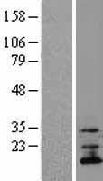 TMEM70 Human Over-expression Lysate