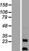 AKIP (AURKAIP1) Human Over-expression Lysate