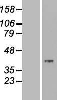 MOSC2 (MARC2) Human Over-expression Lysate