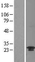 C20orf11 (GID8) Human Over-expression Lysate