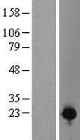 CZIB Human Over-expression Lysate