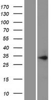 PIH1D1 Human Over-expression Lysate