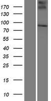 SMPD4 Human Over-expression Lysate