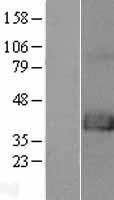 FAM70A (TMEM255A) Human Over-expression Lysate