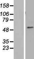 C1orf181 (ZNHIT6) Human Over-expression Lysate