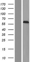 C14orf118 (GPATCH2L) Human Over-expression Lysate