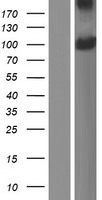 PDPR Human Over-expression Lysate