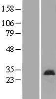 DMAC2 Human Over-expression Lysate