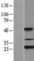AKIRIN2 Human Over-expression Lysate