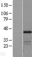 SSBP3 Human Over-expression Lysate