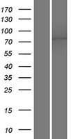 TMEM16K (ANO10) Human Over-expression Lysate