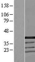 YJU2 Human Over-expression Lysate