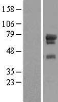 WDR79 (WRAP53) Human Over-expression Lysate