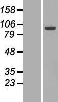 ECT2 Human Over-expression Lysate