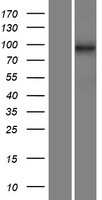 C14orf104 (DNAAF2) Human Over-expression Lysate
