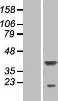 P15RS (RPRD1A) Human Over-expression Lysate