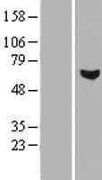 CLLD7 (RCBTB1) Human Over-expression Lysate