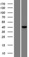 CARKD (NAXD) Human Over-expression Lysate