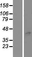 STEAP3 Human Over-expression Lysate