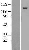NUP133 Human Over-expression Lysate