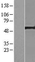 AP5M1 Human Over-expression Lysate