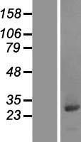 CCDC25 Human Over-expression Lysate